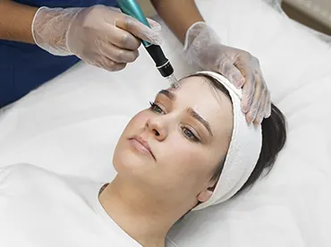dermapen en managua