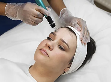 Dermapen para cicatrices