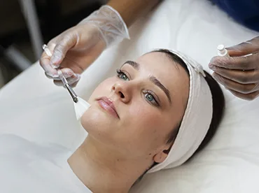 peeling facial en managua