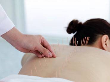 spa acupuntura en managua
